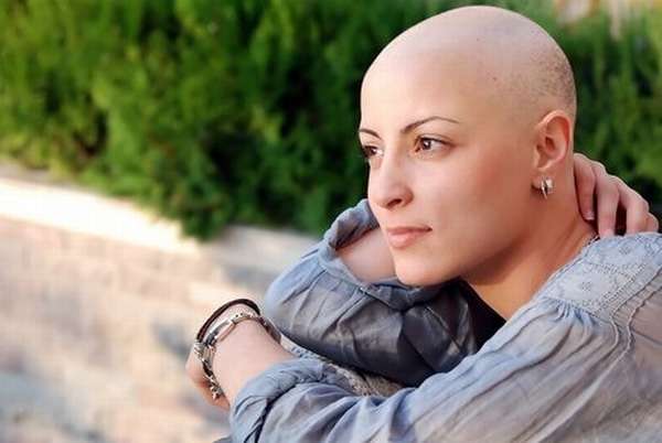 Выпадение волос после курса химиотерапии