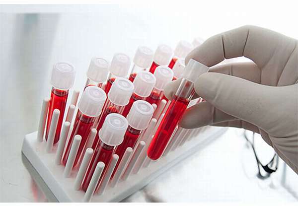 Биохимический анализ крови при отравлении thumbnail