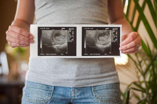 Узнайте все о том, что показывает первый скрининг при беременности.