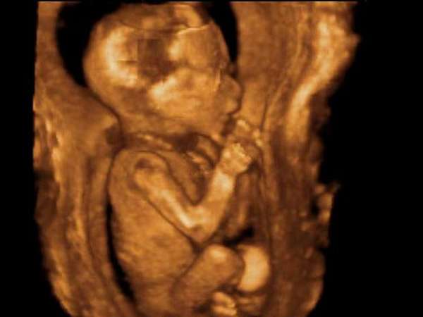 Очень часто после 3д УЗИ при беременности родители делают первое фото малыша.