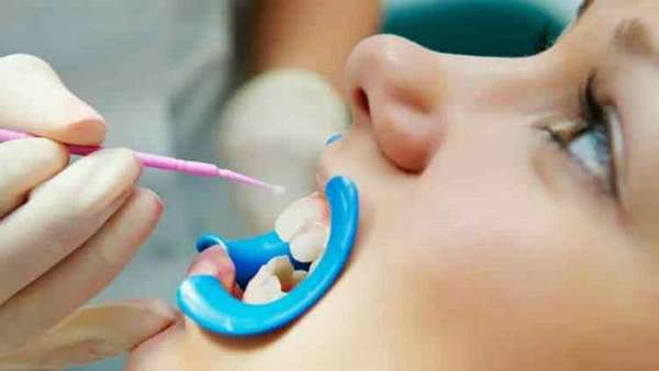 Посеребрение зубов у детей является абсолютно безболезненной процедурой.