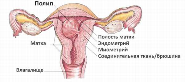 Биопсия шейки матки как и зачем делают, показания к проведению анализа