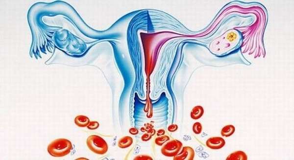 Сильные выделения из влагалища при менструальном цикле