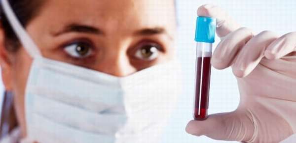 Определение онкомаркеров в крови при карциноме яичников