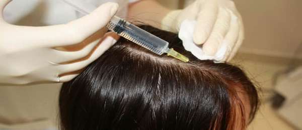 Причины выпадения волос в послеродовый период