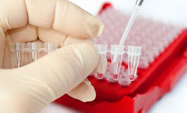 Лабораторный анализ крови при цистаденоме