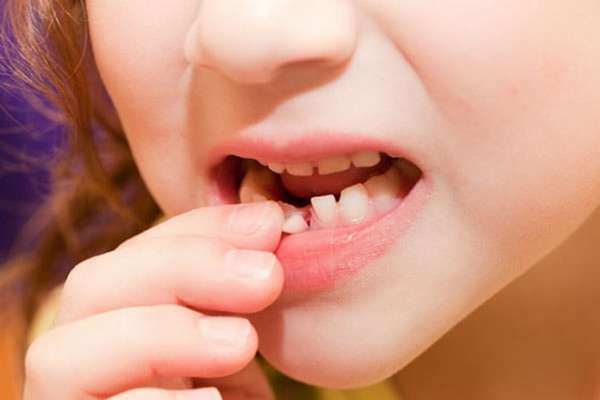 Схема выпадения молочных зубов у детей