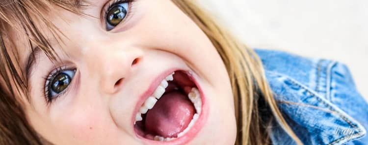 Почему кривые зубы у детей: молочные и коренные, фото