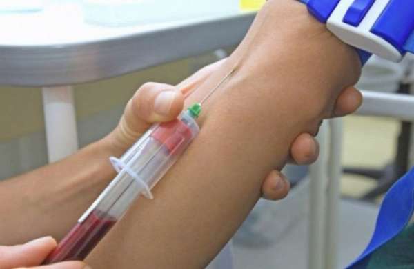Более эффективным и менее травматичным является анализ крови на аллергию.