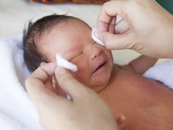 Конъюнктивит у новорожденного: чем лечить