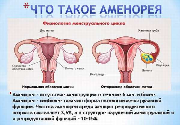 Как проявляется дисфункция яичников репродуктивного периода