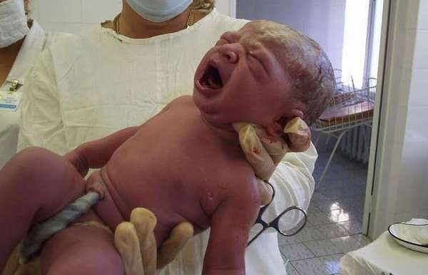 окошно в сердце у новорожденного в норме закрывается при первом крике малыша, а далее понемногу полностью зарастает, становясь перегородкой.
