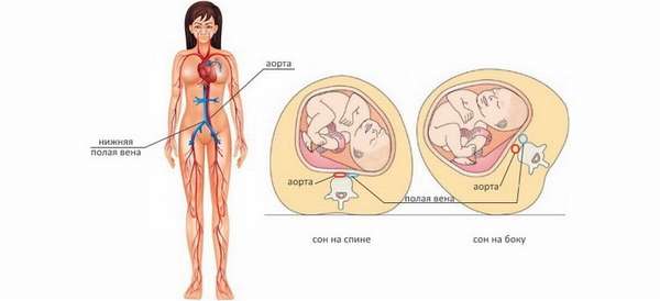 почему беременным нельзя лежать на спине и на что влияет такое положение тела матери
