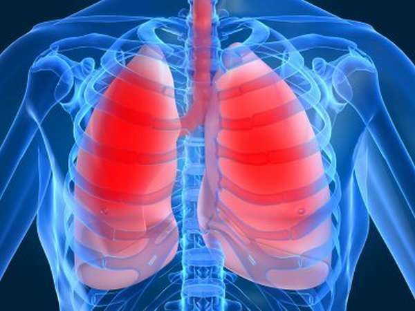 Лечение острой дыхательной недостаточности при пневмонии thumbnail
