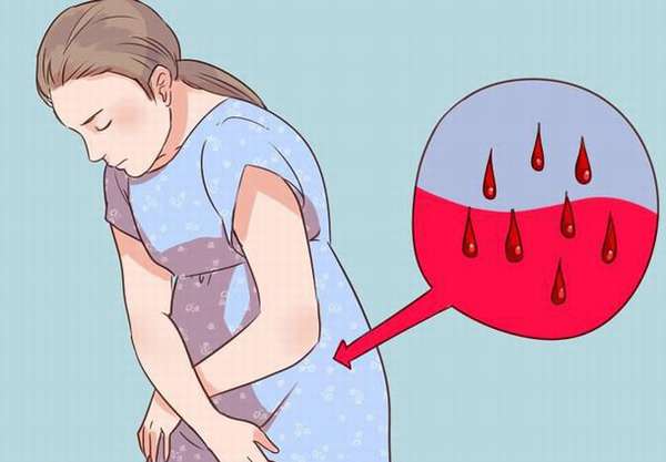 Причины и симптомы маточного кровотечения
