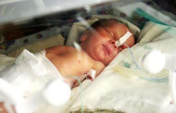 Врожденная внутриутробная пневмония у новорожденных thumbnail