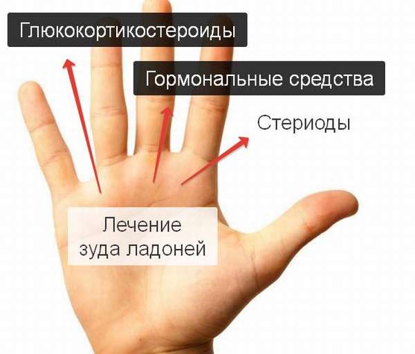 Почему чешутся пальцы на левой руке. Почему постоянно чешется левая ладонь. Почему постоянно чешется правая ладошка. Если чешется правая рука ладонь.