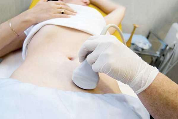 Киста яичника при беременности часто определяется на ранних сроках часто определяется при плановом УЗИ.