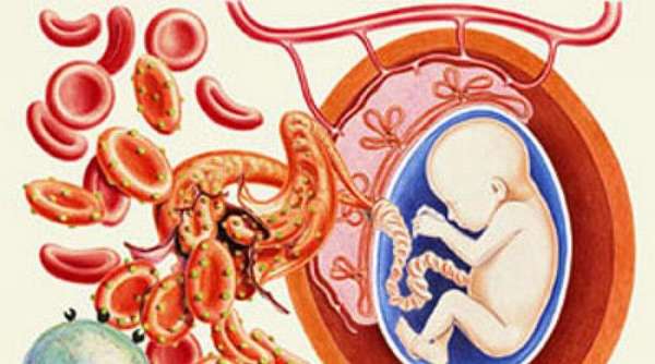 Если при беременности врачи определили у плода гемолитическую болезнь, за женщиной и будущим ребенком ведется постоянное наблюдение.