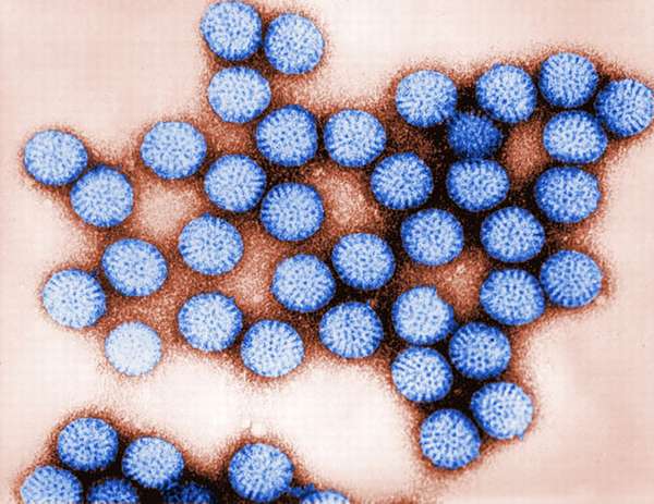Ротавирус — инфекционное заболевание, поражающее людей разного возраста.