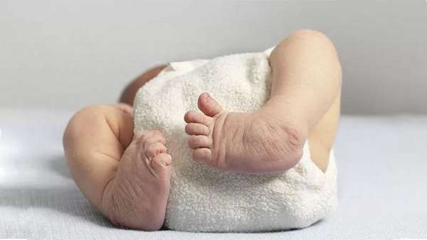 Ношение подгусзника, из-за которого ножки ребенка разводятся в стороны, является хорошей профилактикой дисплазии.