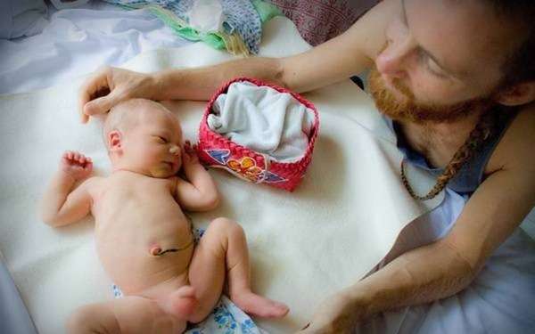 Физиологическая водянка яичек у новорожденных в большинстве случаев проходит сама собой до двухлетнего возраста.