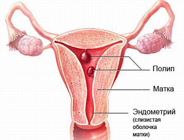 Толщина эндометрия матки во время менопаузы: симптомы гиперплазии