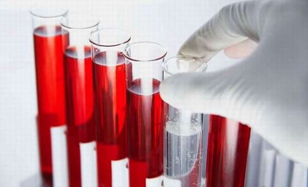 Анализ крови на онкомаркеры при гиперэхогенных образованиях