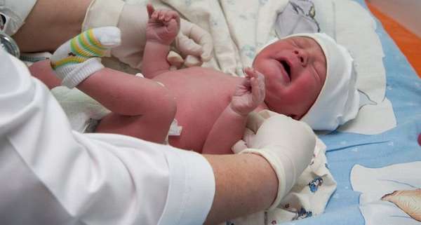 Гипоксия головного мозга у новорожденных может иметь самые страшные последствия вплоть до отставания в развитии.