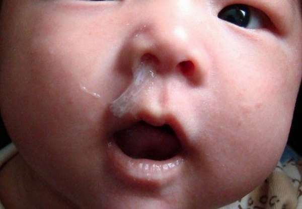 Если же у малыша сопли, на помощь придут капли в нос для грудничков от насморка.