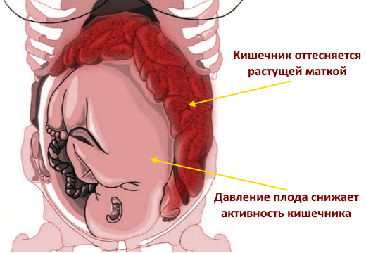смещение кишечника при беременности