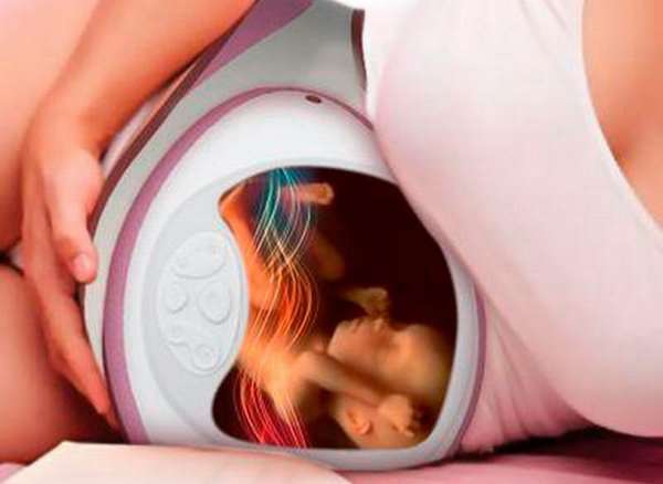 бандаж способствует не только снятию нагрузки с живота и позвоночника женщины, но и физиологически правильному положению малыша в утробе.