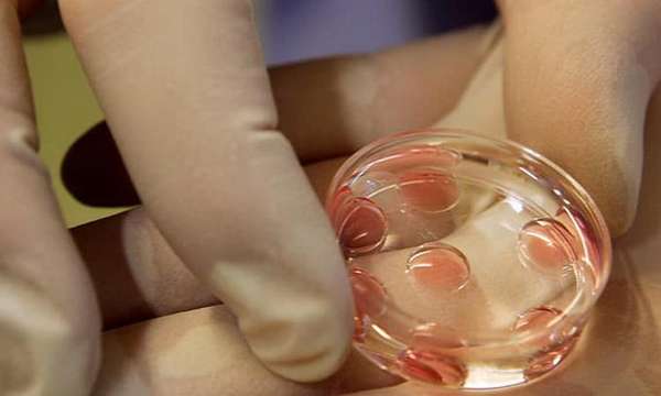 Как происходит подсадка эмбриона в естественном цикле