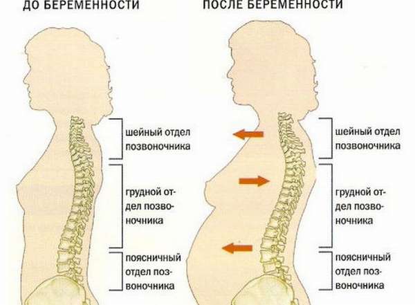 То, что болит спина во время беременности, не удивительно, ведь центр тяжести в теле женщины смещается.